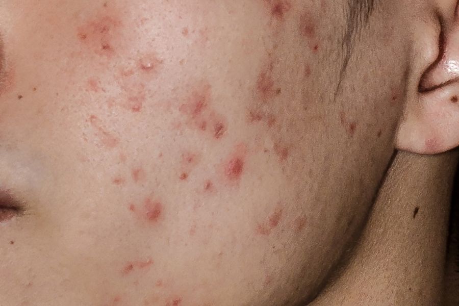 formulas magistrales